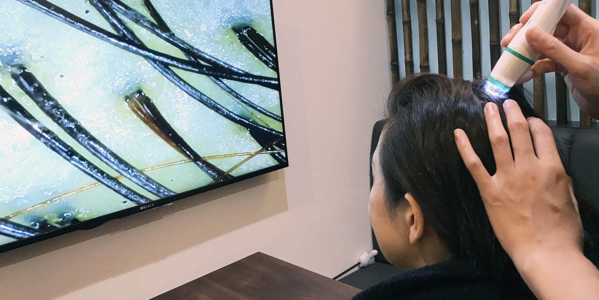 スコープで頭皮の状態をチェック